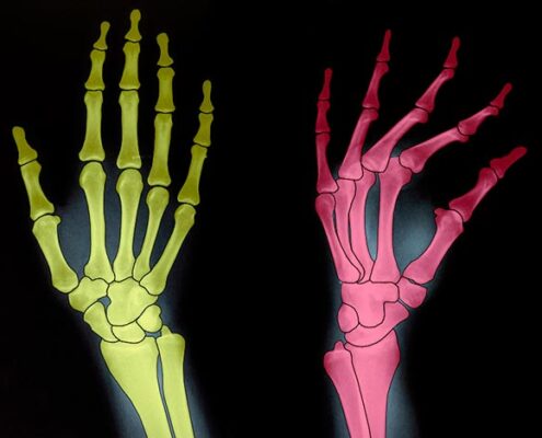Semantic Segmentation for medical Images